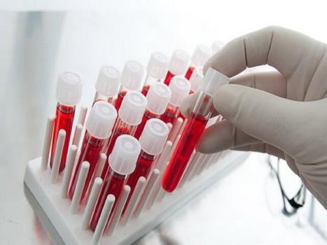 چگونگی فعالیت مراکز ملی تأمین سلول های بنیادی در سازمان انتقال خون