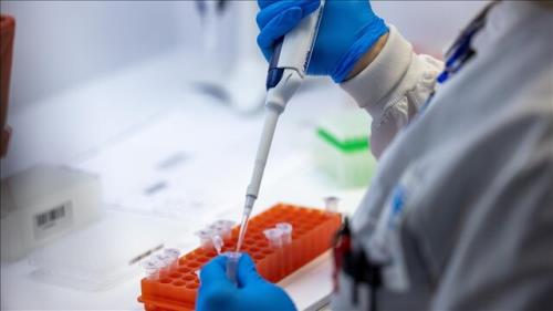 شناسایی یک فرد دچار آبله میمونی در اردن