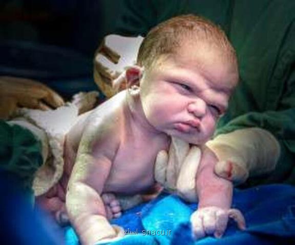 مسابقه ای كه هر كس زودتر برسد بازنده است!